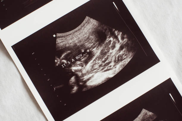 Ultrasound training and the remote guidance protocol